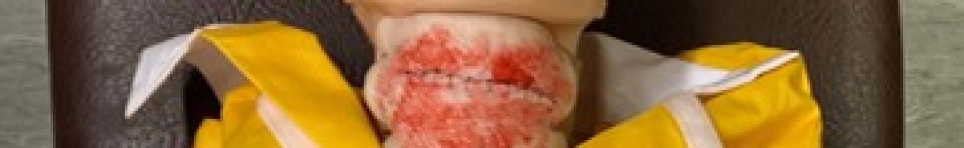 Blood soaked bandage applied to the throat